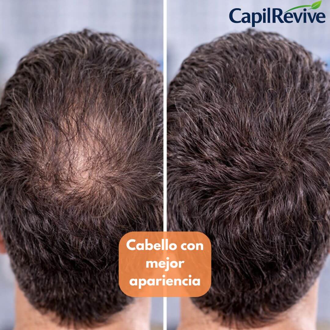 CapilRevive – Shampoo Anticaída – Ayuda a fortalecer tu cabello desde la raíz