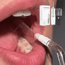 Irrigador Bucal Recargable / Limpieza Dental de Efecto Inmediato / Previene Gingivitis y Caries / Incluye 4 Boquillas + Limpiador de Lengua de REGALO