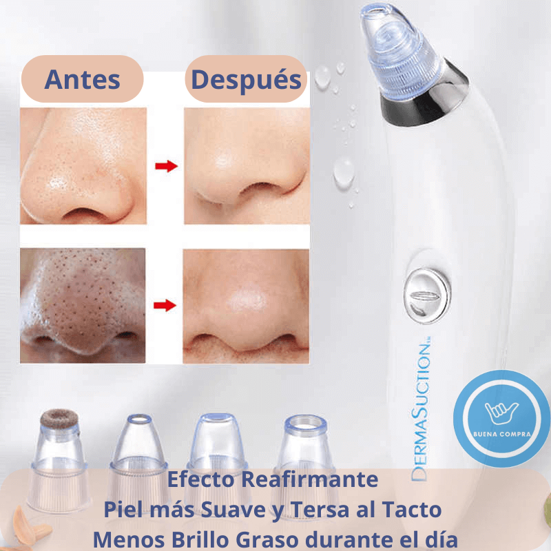 Derma Suction: EXTRACTOR PUNTOS NEGROS / Elimina los puntos negros desde el primer uso, sin dolor, sin irritaciones / Incluye 4 cabezales de Regalo