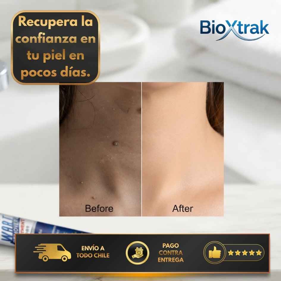 BioXtrak - Fórmula Avanzada para Eliminar Verrugas