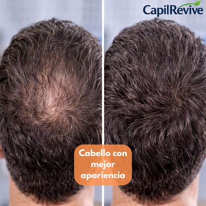 CapilRevive – Shampoo Anticaída – Ayuda a fortalecer tu cabello desde la raíz