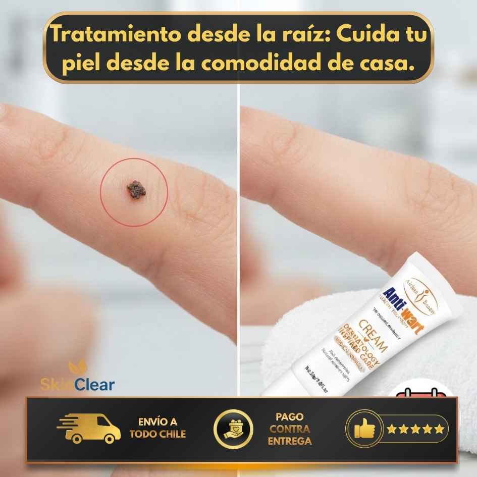 SkinClear - Eliminación de verrugas sin dolor