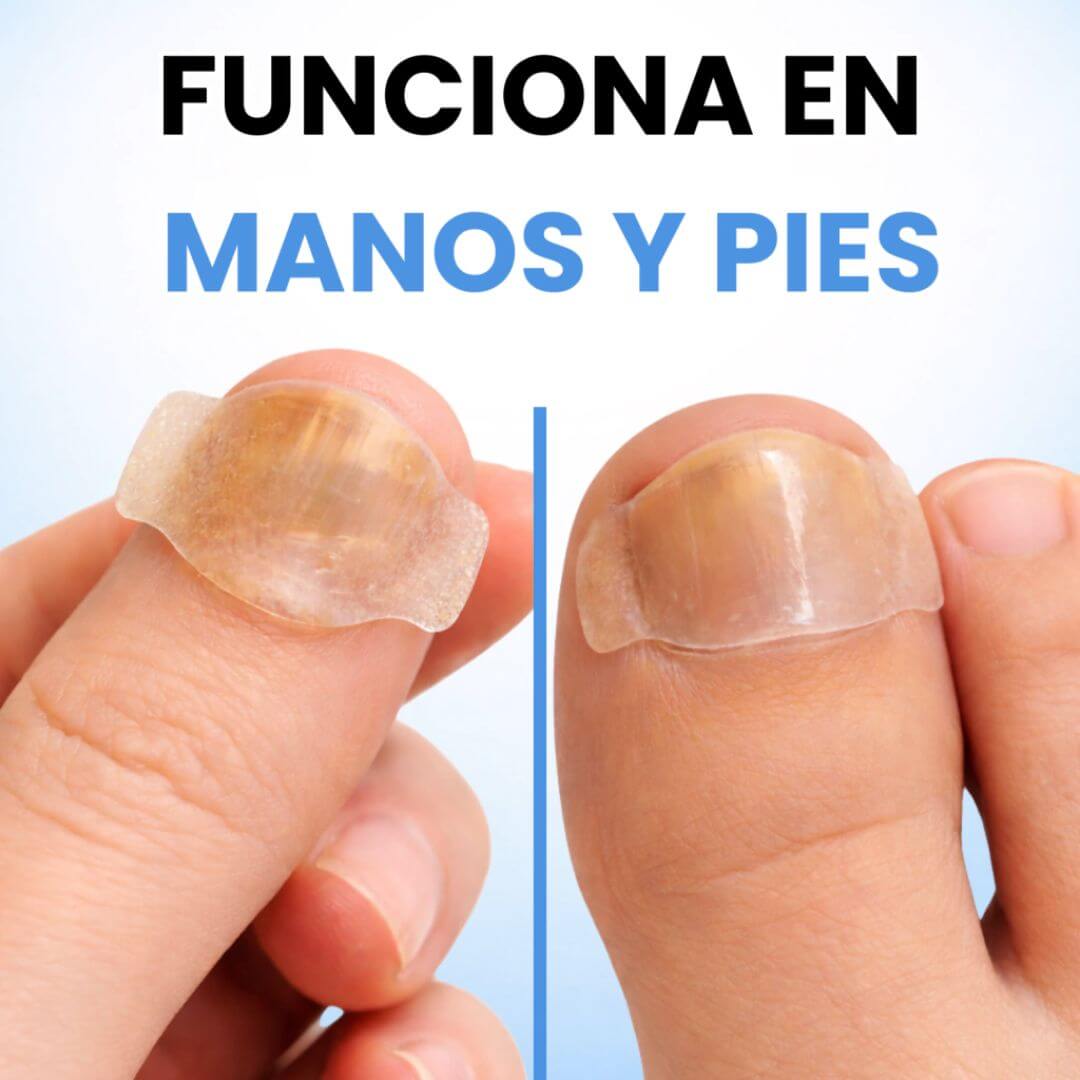 PureNail Patch – 32 Parches - Cuidado Nocturno para Mejorar el Aspecto de las Uñas