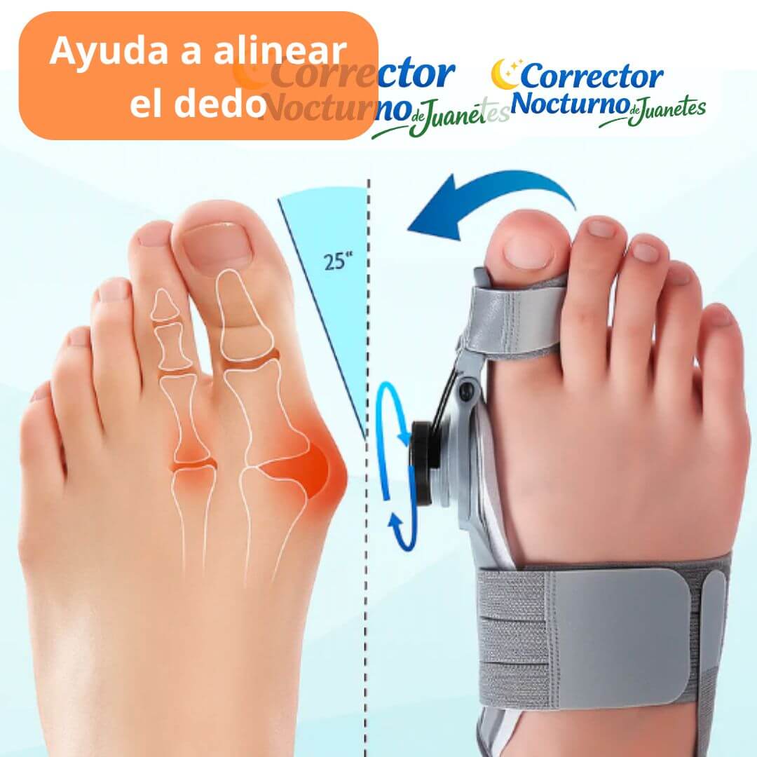 Corrector Nocturno de Juanetes Ajustable - Ayuda a alinear el dedo mientras descansas