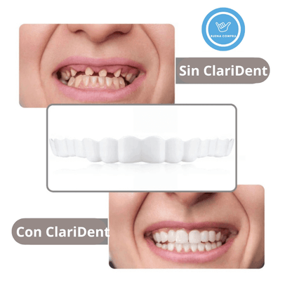ClariDent – Carillas Dentales Removibles – Sonríe Sin Complejos desde HOY y Recupera tu Confianza