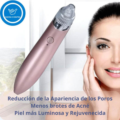 DermaClean Pro - Extractor Puntos Negros 4 Cabezales Recargable USB - Limpieza facial profunda con acabado profesional desde casa