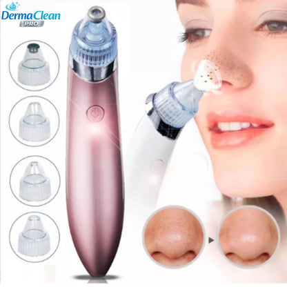 DermaClean Pro - Extractor Puntos Negros 4 Cabezales Recargable USB - Limpieza facial profunda con acabado profesional desde casa